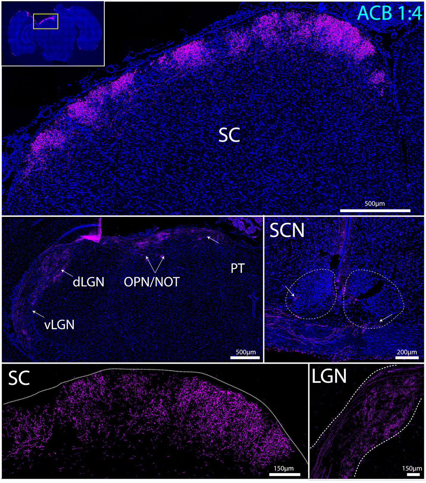 Electric field stimulation